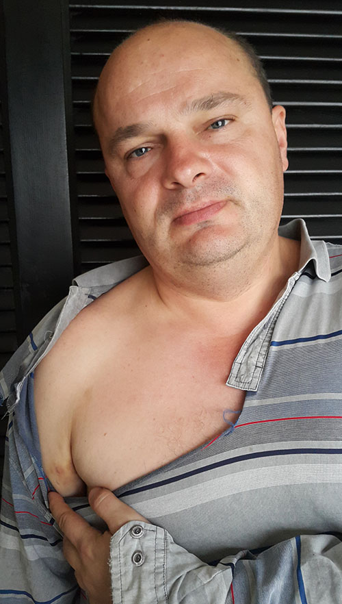 Редактор sprotiv.org Вадим Гладчук в порваной рубашке и синяком на плече